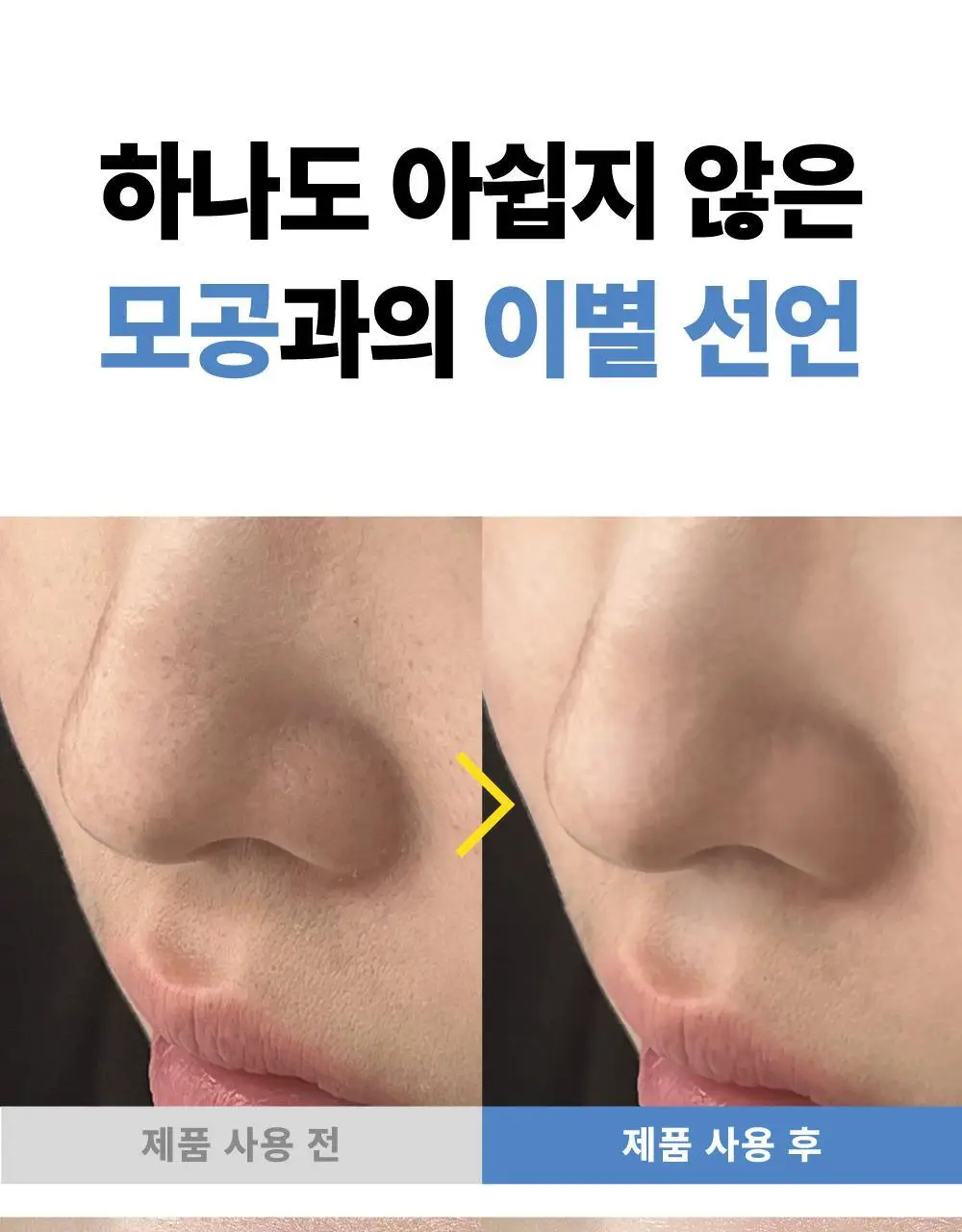 [500억유산균팩] 써니콘 마이크로바이옴 유산균 모델링팩 (7개입) 상세페이지 14